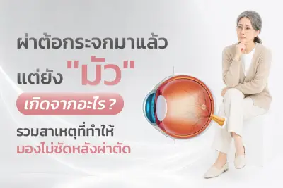 ผ่าต้อกระจกมาแล้วแต่ยังมัว